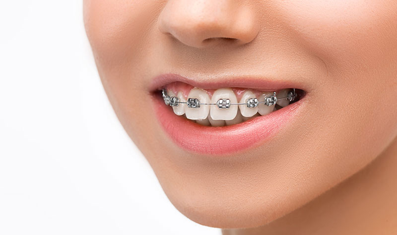 clinica dental para ortodoncia